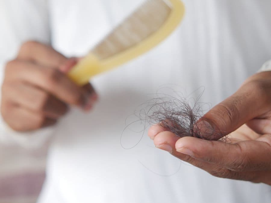 Anti-hair fall program consultation